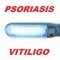 Lâmpada de fototerapia UV-B psoríase, Vitiligo, Eczema, dermatite